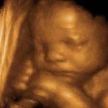 Fundraising Page: Cara Pessel